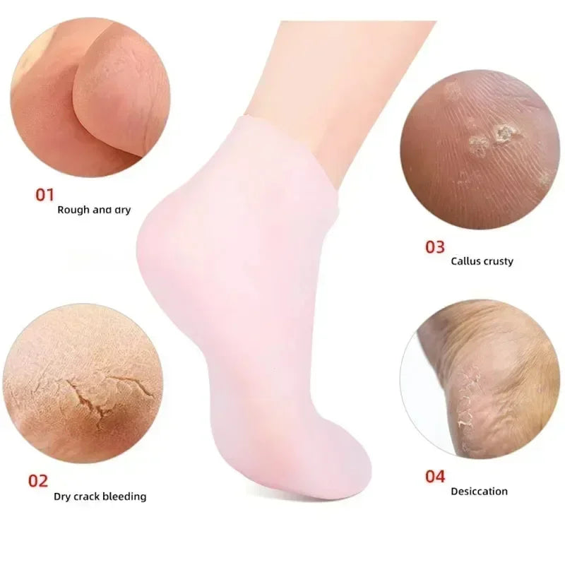 Silicone Moisturizing Socks for Cracked Heels