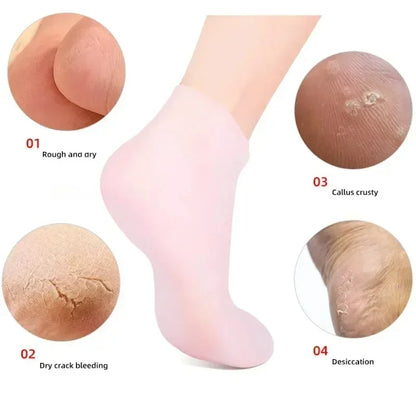 Silicone Moisturizing Socks for Cracked Heels