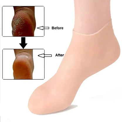 Silicone Moisturizing Socks for Cracked Heels