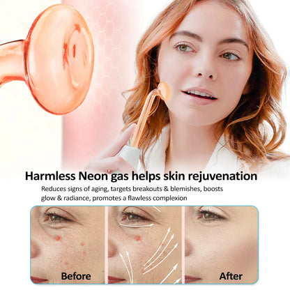 High Frequency Facial Machine for Skin Care